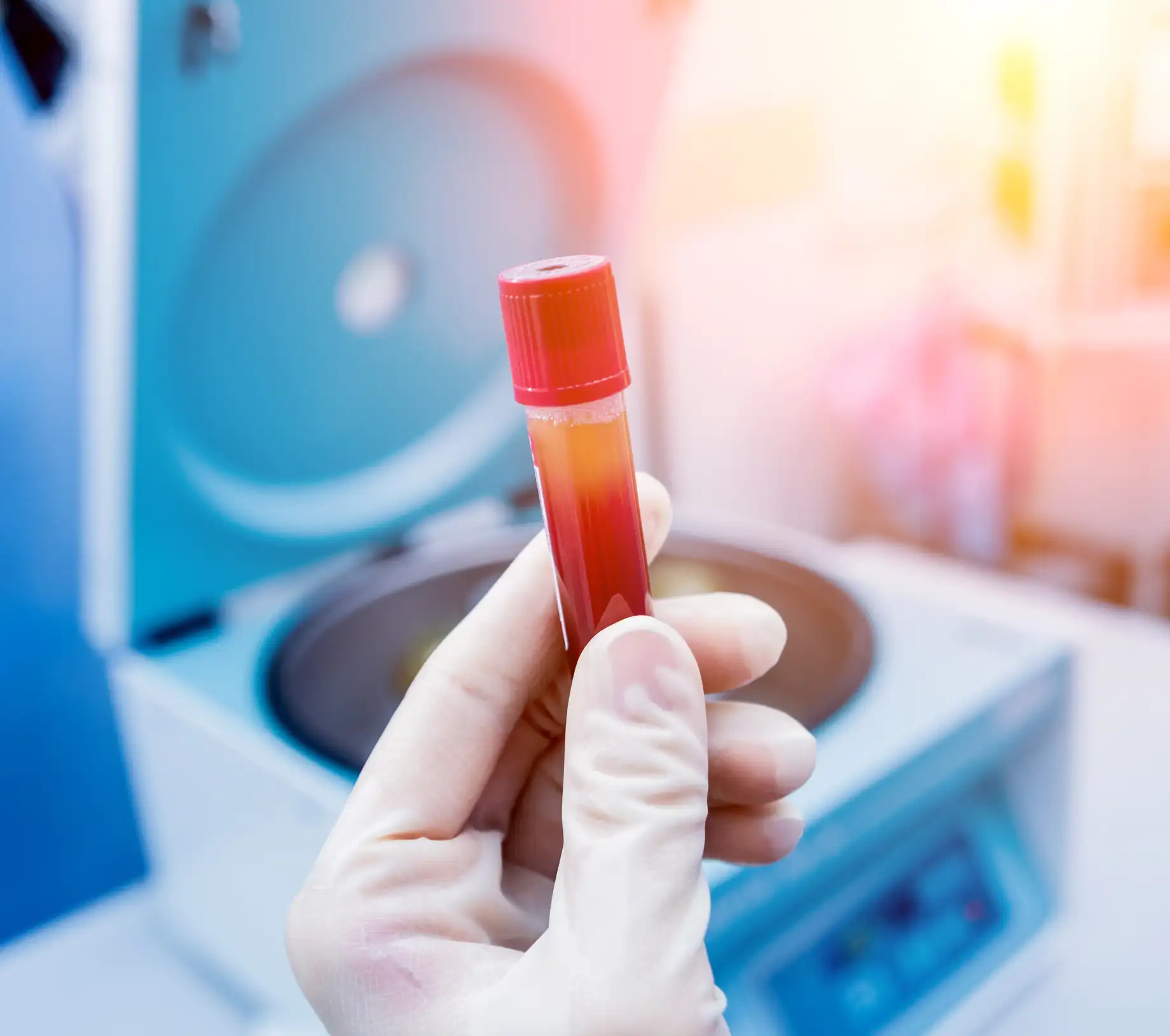 Elevating Healing through Innovation: The Freezing Method in PRP Therapy
