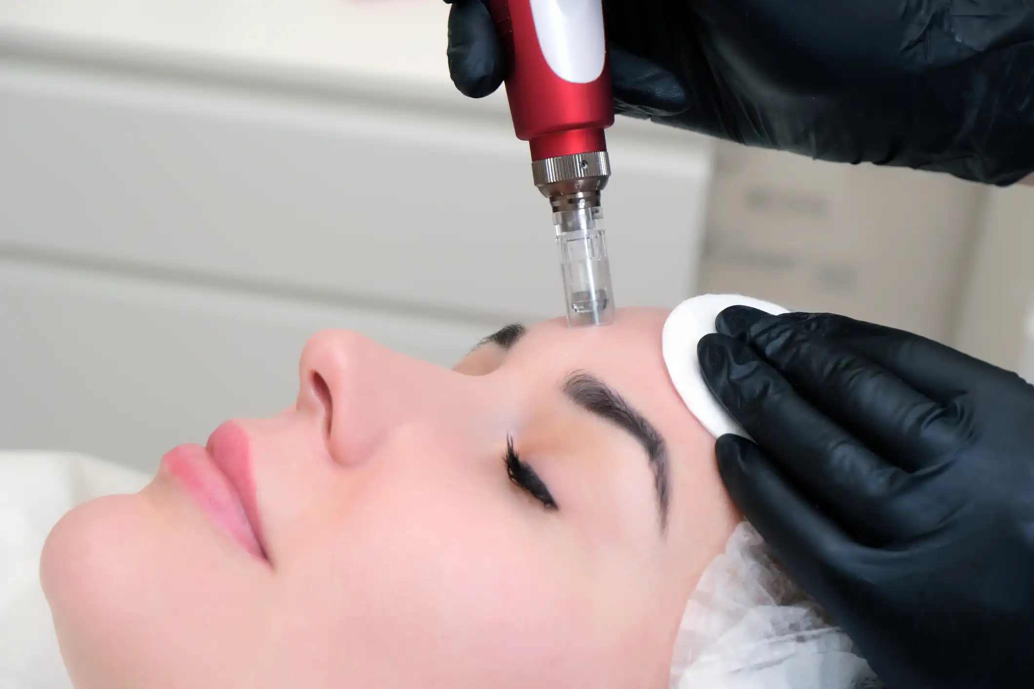 PRP Injections and the Rising Popularity of Vampire Facials: A Glimpse into the Future of Aesthetic Medicine